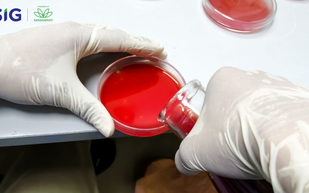 Sheep Blood Agar