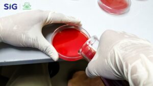 Sheep Blood Agar