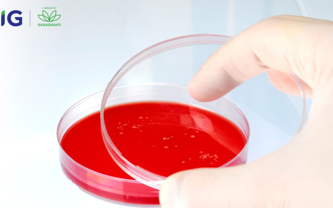 Sheep Blood Agar