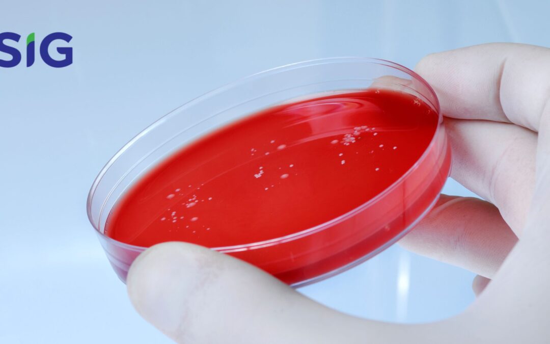 Sheep Blood Agar